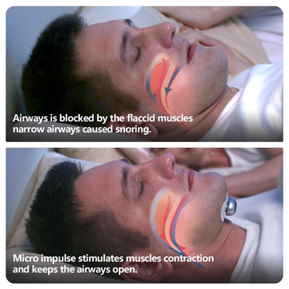Electronic Muscle Stimulator | Anti Snore Device | Topsuper